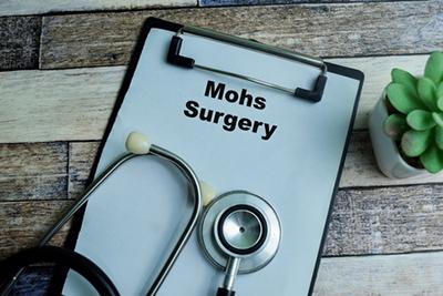 What To Know about Mohs Surgery
